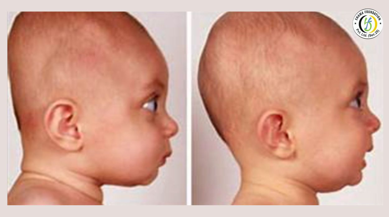 Understanding Newborn Head Shape: Easing Parental Anxiety with Expert Guidance