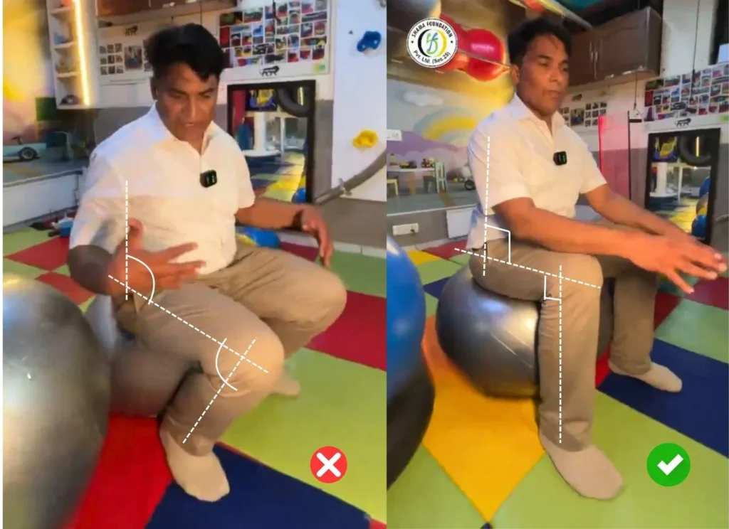 correct-size-therapy-ball-sitting-position-in-cerebral-pasly-special-child-by-Dr M Yoosufwebp